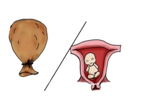 宫腔镜手术治疗：医保是否可以报销？